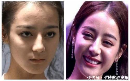 滋生闭口的有这几种原因!很多人都中招,