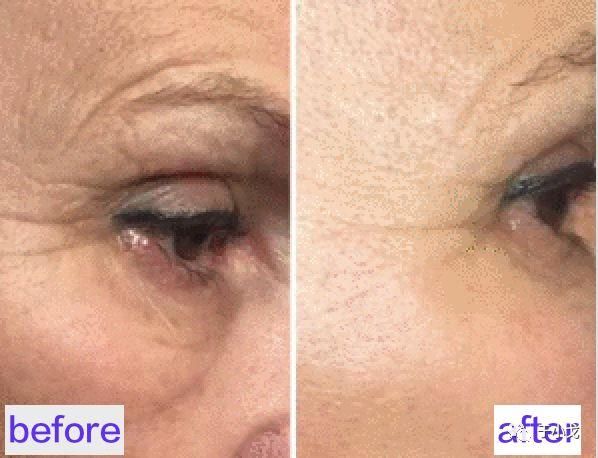 曝大S童年"黑"历史,拼命美白会有害健康么?