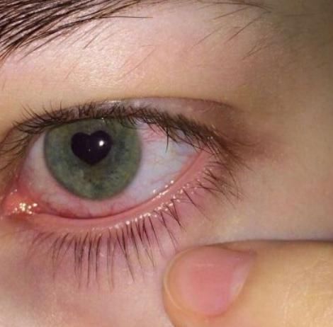  自查|有这“3种眼型”的女孩一般很漂亮，自带魅力更招人喜欢，不妨自查
