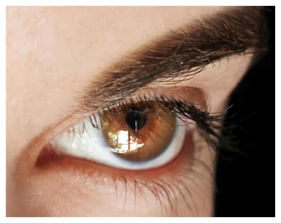 嫌人类丑，男孩花巨款将自己整形成了精灵，是绝美还是惊悚