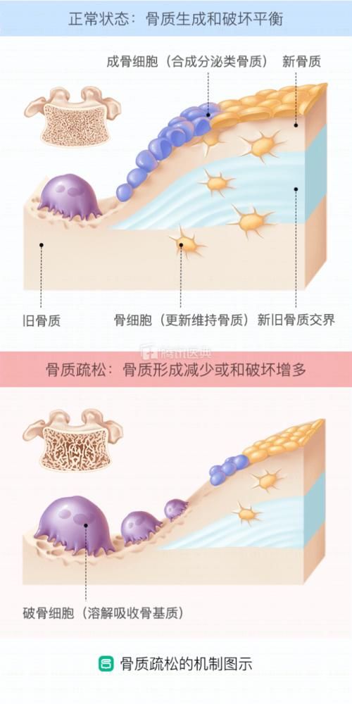  [阳光]年轻女性才需要防晒？医生：天真，这3类人群也要防晒，否则有皮肤癌风险