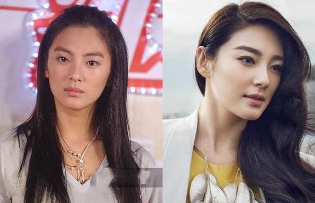  『影响』双眼皮术后恢复时间受哪些因素影响