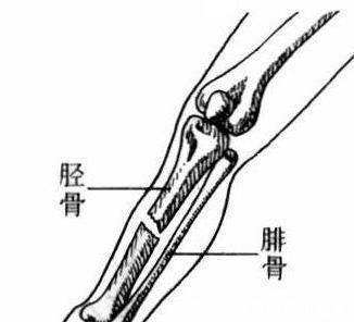  历史@死得最窝囊的秦国君王，《芈月传》的历史细节