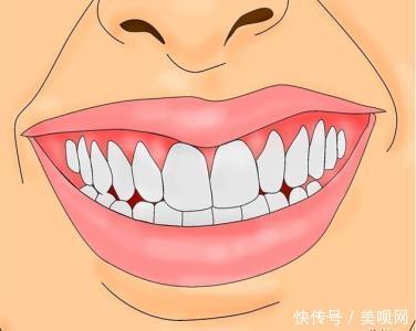 『法令纹出现』别让你的法令纹,泄露了你的年龄!