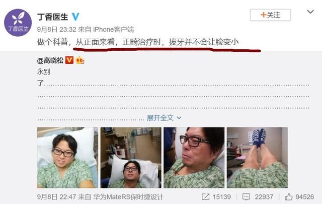 丁香医生拆台高晓松:拔牙不会让脸变小,那杨颖杨幂是怎么回事?