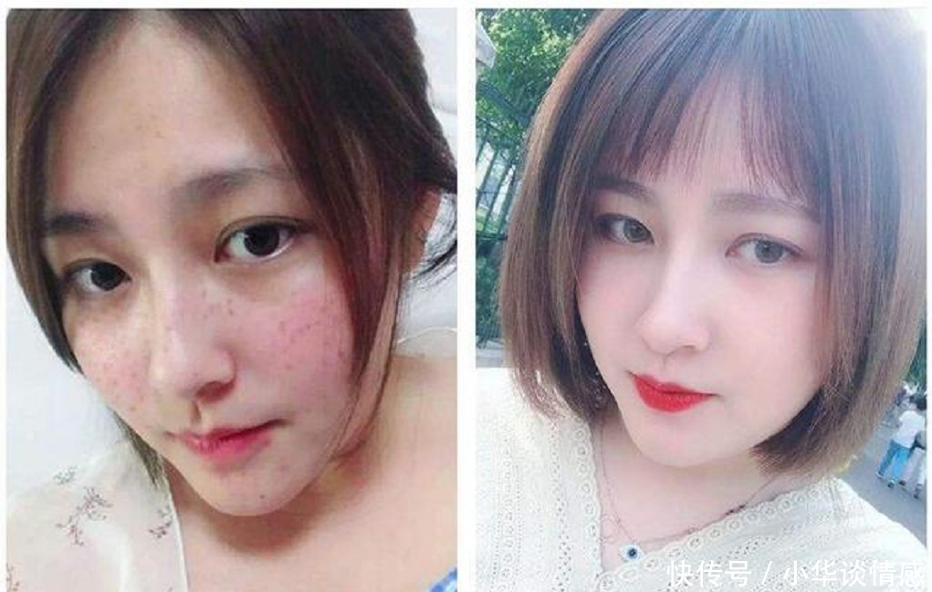 #白淡斑#牛奶搭上“它”,美白淡斑太给力,用了20来天,皮肤白嫩多了!