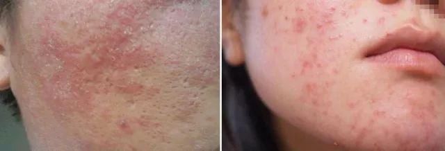 古力娜扎带火的娜丽丝要停产了?这款防晒喷雾明明更好用!