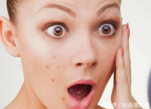 毛孔堵塞长痘怎么办?毛孔堵塞长痘用什么好