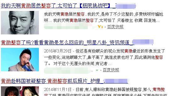 过分了！黄渤也被质疑整形他的回应比上次回怼曾志伟更聪明