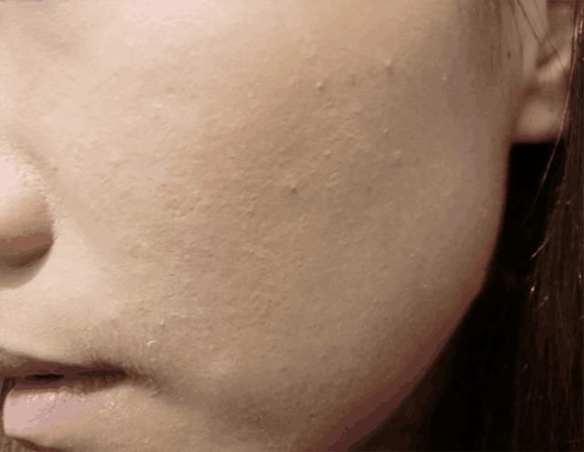 医生提醒：粗大毛孔像“筛子”, 坚持每天洗1种水，毛孔一小再小