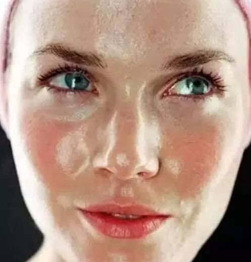 隐形的脸上“杀手” 如何才能彻底脸上螨虫?教你一小妙招