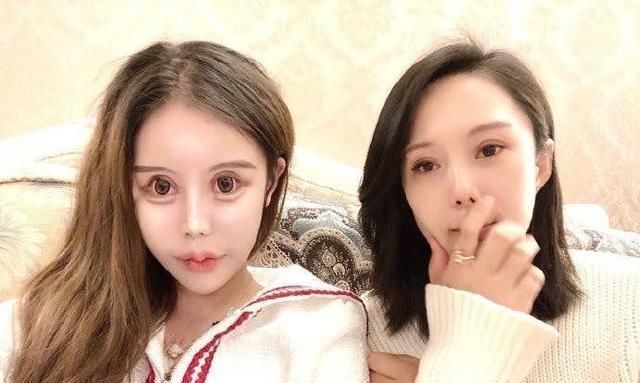 女生:16岁女生整容60次花费过百万割双眼皮、隆鼻、磨骨变做人形芭比