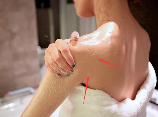 提醒：洗背搓出的你以为是泥儿？很可能是螨虫的痕迹