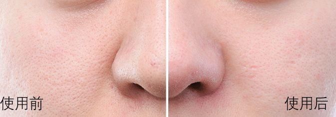 拔出黑头粉刺，地毯式清洁肌肤，还能缩小毛孔!素颜也自带妆容