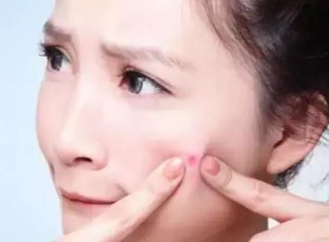 脸出现3个信号，其实是你脸上螨虫太多