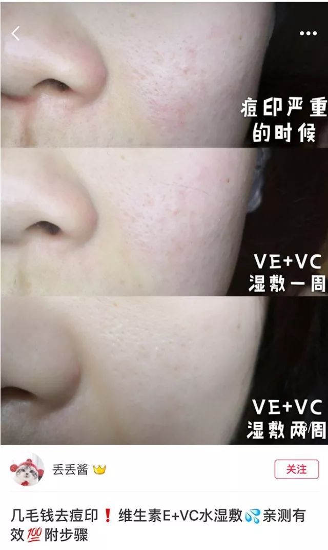 性价比逆天!大瓶好用的湿敷新宠，美白补水缩毛孔，0差评，上架就