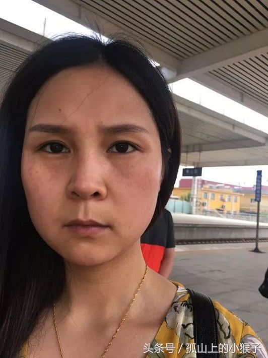 38岁女人长出“老年斑”别慌张，有一小妙招，轻松去斑不东奔西跑