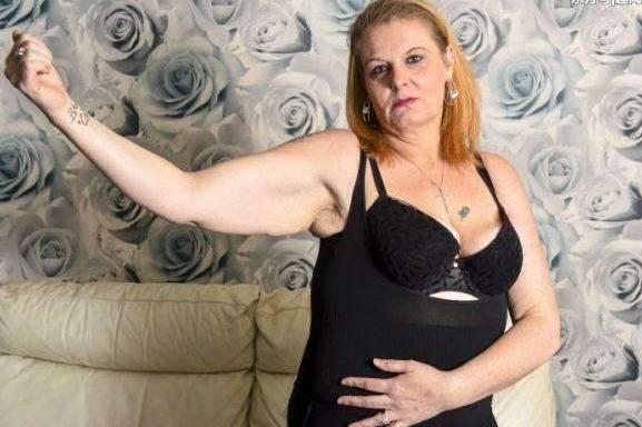 英国女子辛苦减掉150斤, 减肥后的效果却让她后悔不已