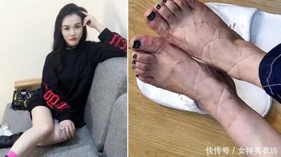 女星的那些奇葩高跟鞋,看着都难受,穿上真的是有勇气!