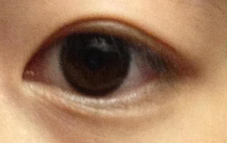 做完双眼皮的人再跟之前相比，判若两人，等到花甲之年会怎样呢?