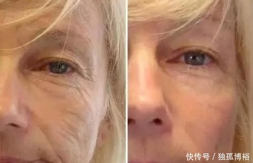  『皮肤』用了这么多护肤品之后，终于发现了抗衰老的秘诀，原来这么简单