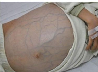 怀疑女儿早恋，半年后女儿肚子疑似怀孕，女儿离世，母亲才知真相