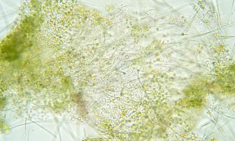  #地球#生物存活不依靠氧气！地球出现大量氧气之前，是一个怎样的世界？