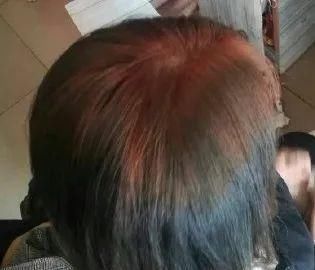 理发@千万不要自己在家染发！别怪没提醒你，否则后悔都来不及了......