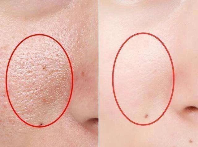 很多女性都“瞧不起”超市里2块钱的它，睡前擦一擦，完爆玻尿酸