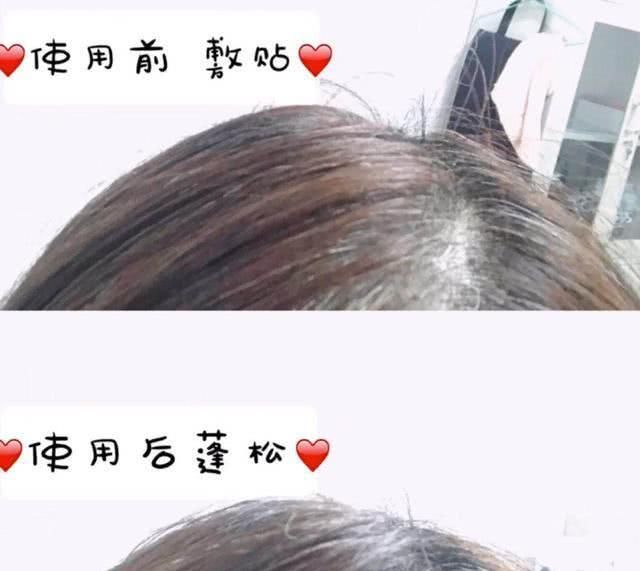  细软@轻松拯救你的发量，让你从此告别“细软塌”，赶紧get起来吧