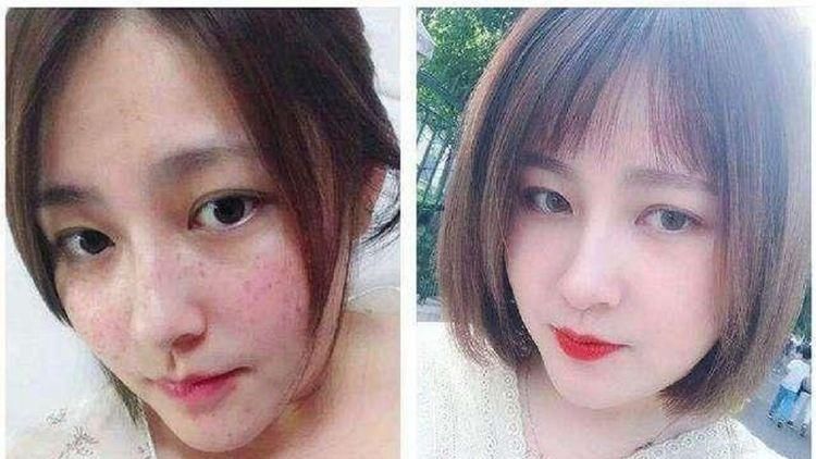  #皮肤护理#美白祛斑堪比大牌护肤品，色斑妹子一定别错过啦马齿苋加它敷脸