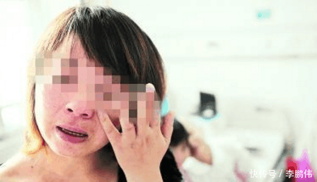 37岁孕妇孕4月突然腹痛, 当即被要求手术, 剖开