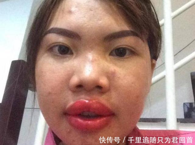 漂亮：从丑女变成漂亮女神，嫁给了富二代，21岁丑女花费10万元整容