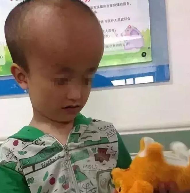 头越大越聪明? 通过头围看宝宝健康指标