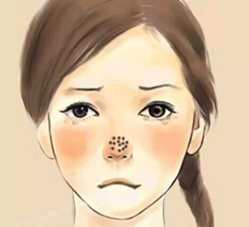  [漂亮]不试几个方法，长的漂亮也是被鼻子拖后腿，让你从此告别草莓鼻