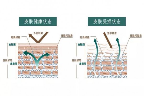 林清轩专注女性肌肤 帮助修复皮肤