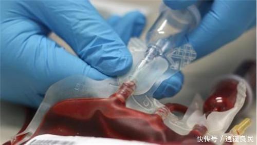  发现|全世界最珍贵血型，仅我国存在一例，能救任何人却不能被任