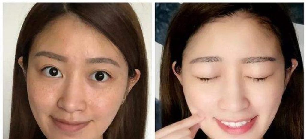  [恢复]开塞露和它混合敷脸,一周美白淡化斑点,恢复白皙滑嫩的皮肤
