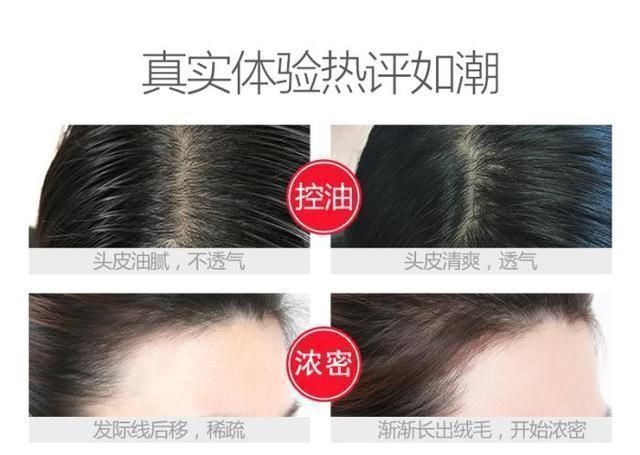  脱发@屈臣氏有款“断货王”，被称洗发水界的阿玛尼，知道的人却很少！