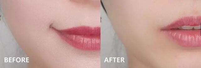 女子25年不卸妆竟长出结石!看完实在令人毛骨悚然……