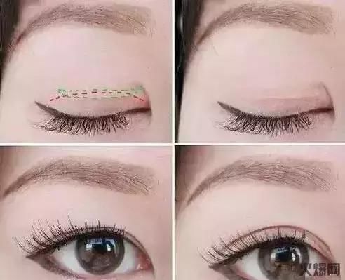 双眼皮贴的三大危害，你知道吗？