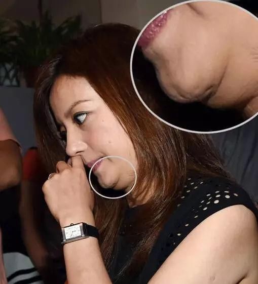 年纪轻轻就有了“双下巴”？你应该这样减！