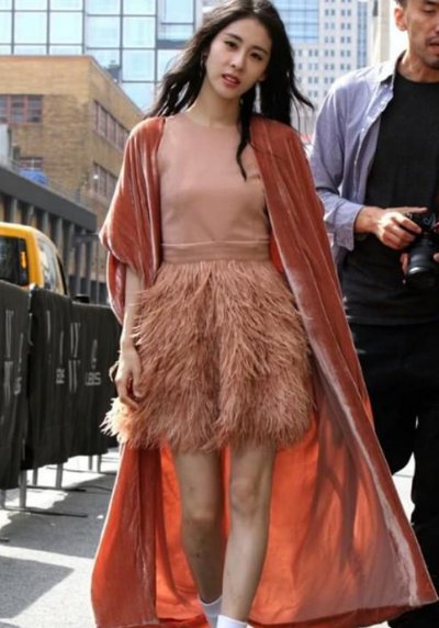 张碧晨太奇葩了，满腿都是小疙瘩还敢穿短裙，网友:到底怎么想的