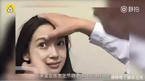 杨颖整容鉴定另有玄机? 医生公开现身辟谣, 网友: 整得好失败!