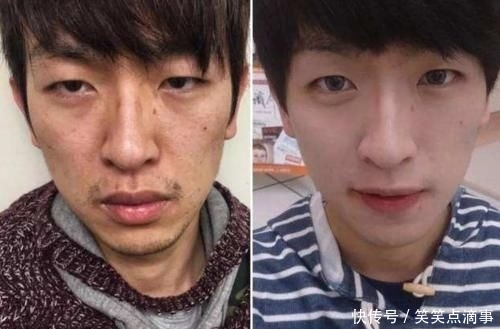 #化妆#“长期化妆”和“长期素颜”哪个对皮肤好?这3大差别一目了然!