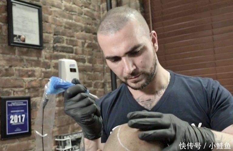 [ 男子]但效果糟糕像滴满油漆，秃顶男子请廉价纹身师在头顶纹头发,