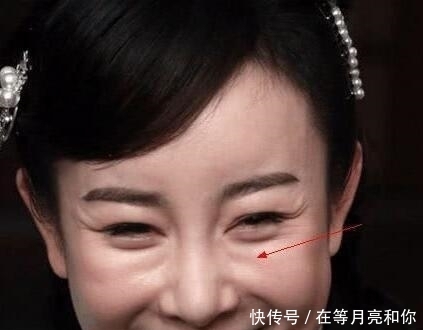  『尿酸』被玻尿酸毁了的六大女星，王心凌像老太太，而她丑到不可接受