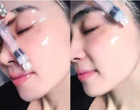 开塞露祛斑要注意哪些?老中医一再提醒:斑点彻底一夜消灭不留痕