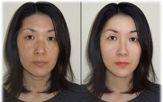 邻居都羡慕了!43岁阿姨用维生素E擦脸，一觉醒来肌肤嫩如婴儿肌