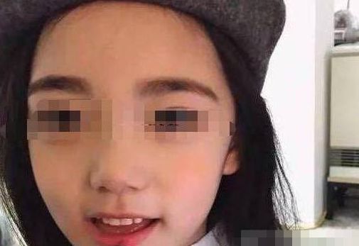 11岁女孩已化妆6年，发现异常后去检查，医生的话让家人后悔莫及